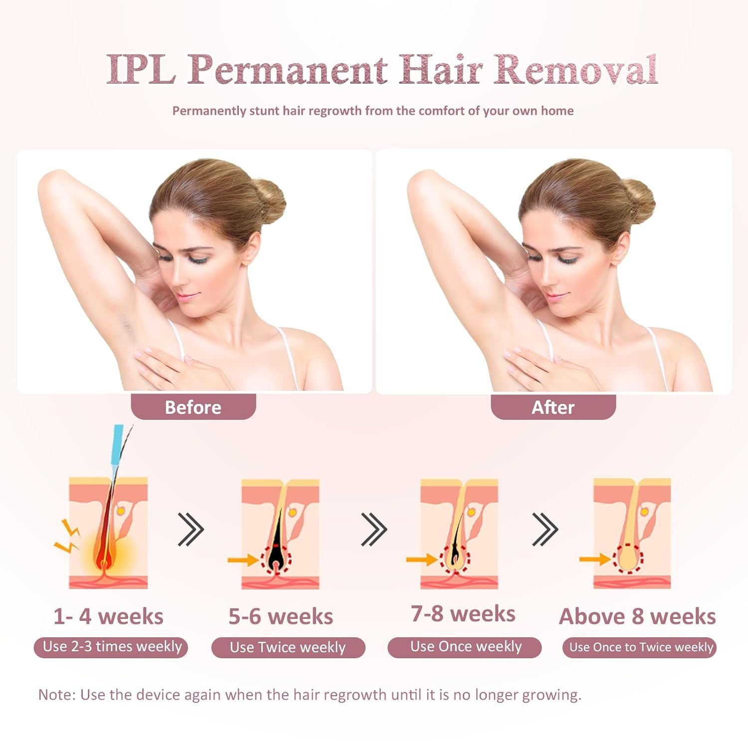 Painless IPL Laser Hair Remover - Permanent Removal for Women and Men